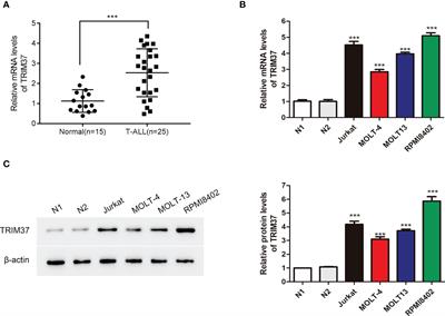 TRIM37 interacts with PTEN to promote the growth of human T-cell acute lymphocytic leukemia cells through regulating PI3K/AKT pathway